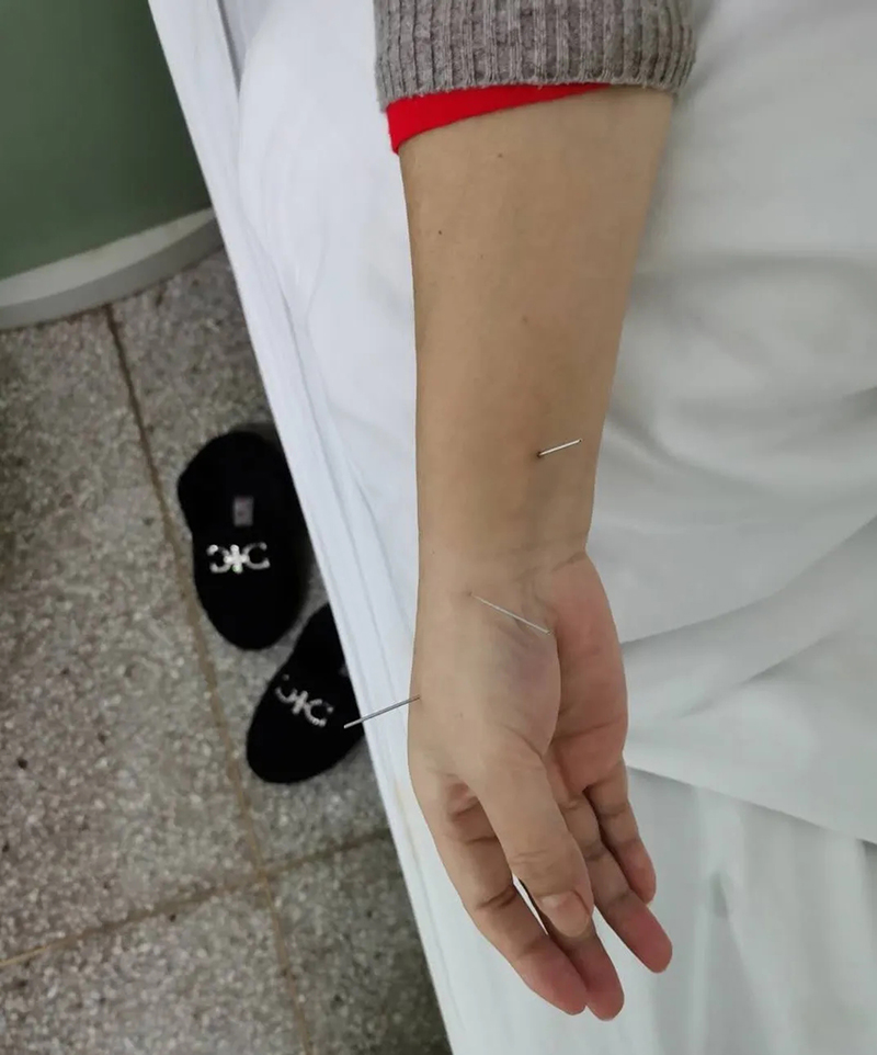 劉力紅對(duì)患者展開(kāi)中醫(yī)治療800（圖片來(lái)源：同有三和基金會(huì)）.jpg